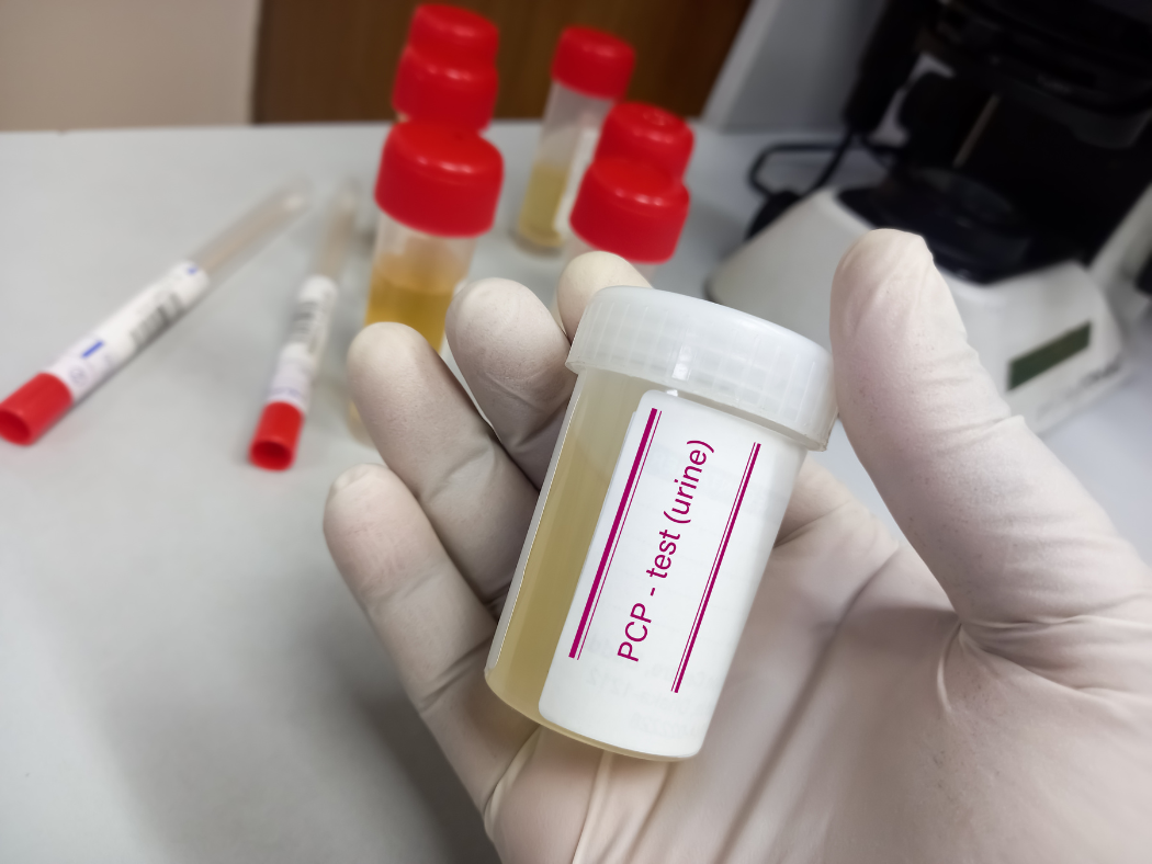 Urine drug test sample
